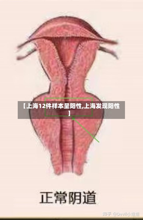 【上海12件样本呈阳性,上海发现阳性】